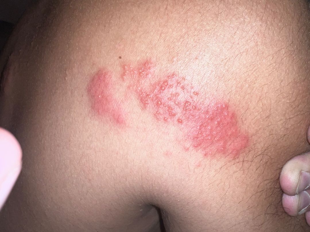 Clinical context view